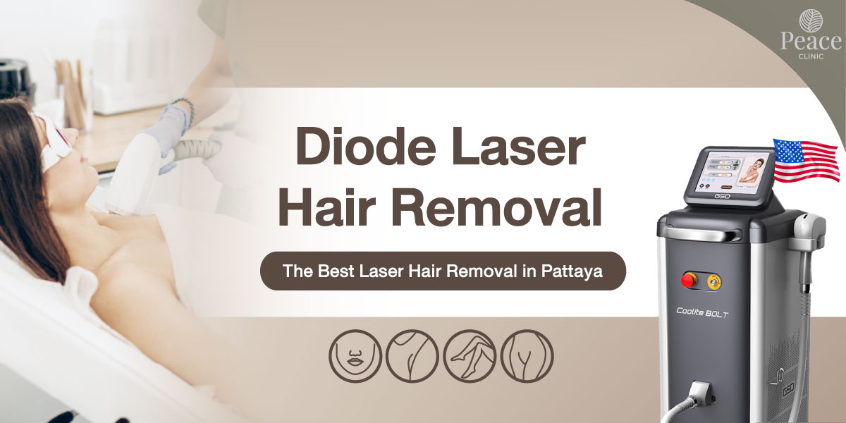 Painless Hair Removal with Laser Diode - Peace Clinic