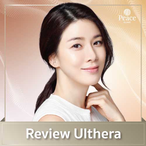 Review Ulthera